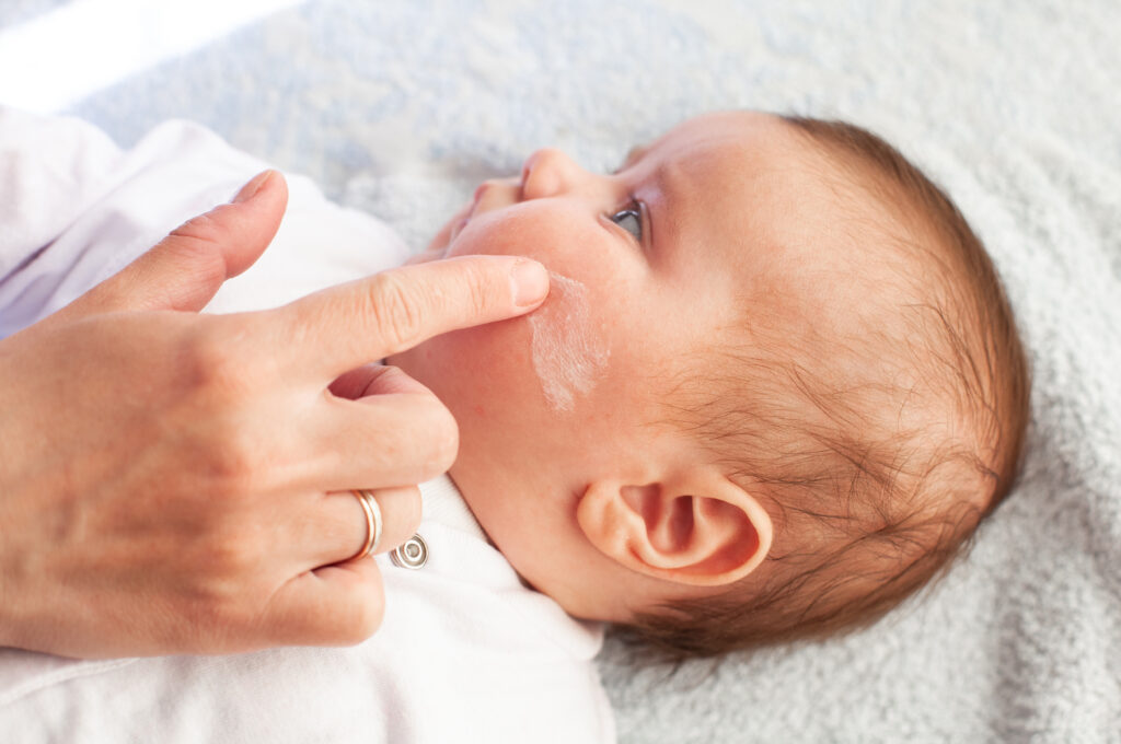 Natural remedies for soothing baby eczema.